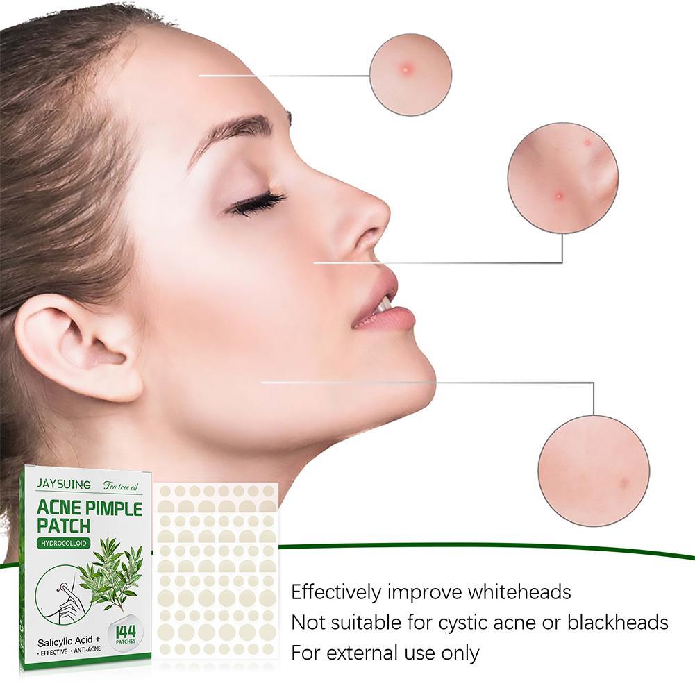 144pcs Acne Pimple Patches Tra - Herbal Wellness Tea ulasan dan harga
